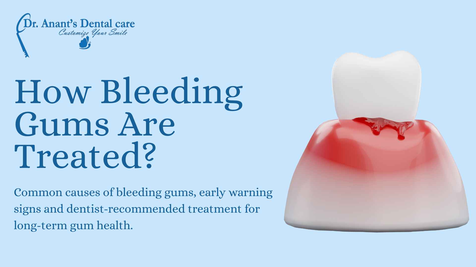 Treatment for bleeding gums explained with emphasis on causes, care, and long-term gum health.