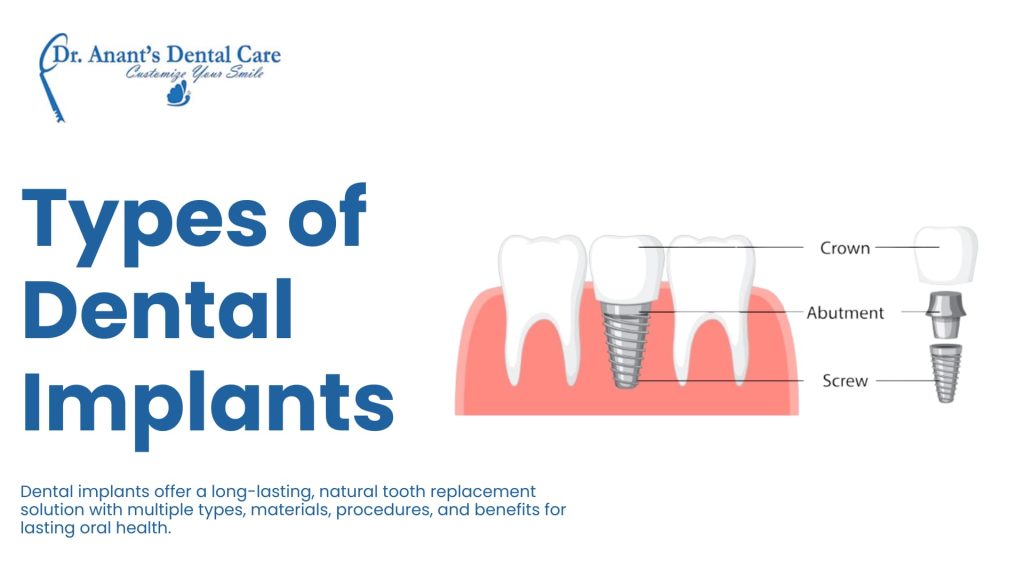 Types of Dental Implants