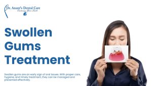 Swollen Gums Treatment