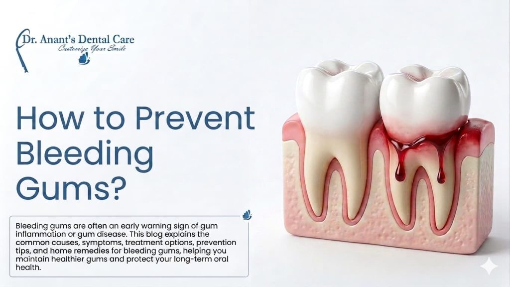 how to prevent bleeding gums