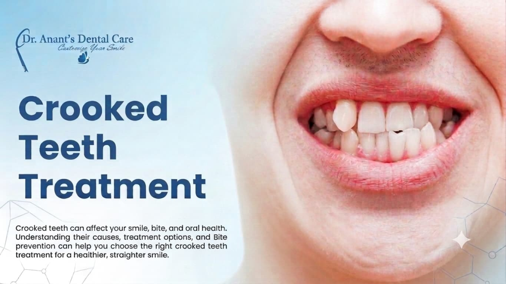 Crooked Teeth Treatment