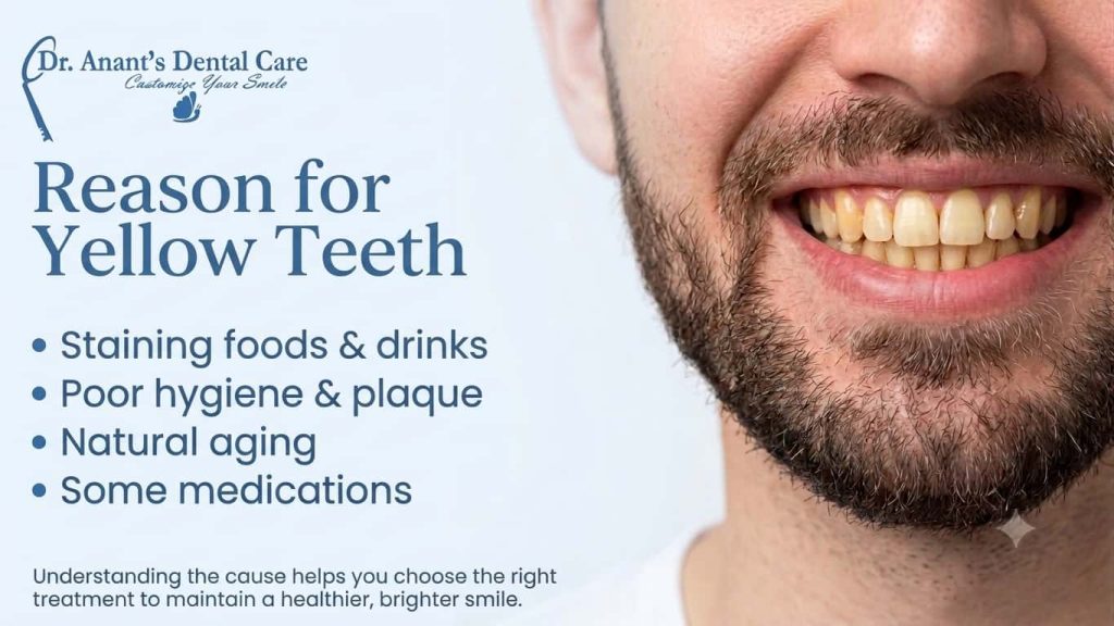 Reason for Yellow Teeth