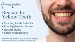 Reason for Yellow Teeth