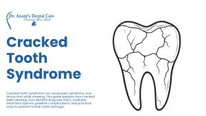 Cracked Tooth Syndrome