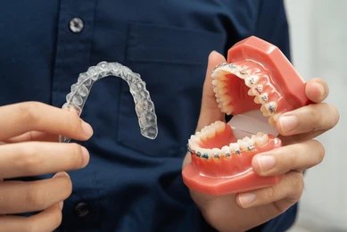 Aligners and Braces
